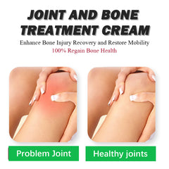 Ximonth Bee Venom Joint Care Cream Body Joint Foot Foot Heel Bone Knee Lumbar Pain Relief Cream
