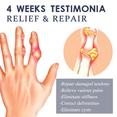 Ximonth Bee Venom Joint Spray, Relieves Hands Legs Bones Knees Lumbar Vertebra Sedentary Joint Pain Body Care Spray