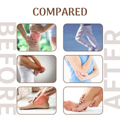 Ximonth Bee Venom Joint Care Spray Relieves Wrist Muscles Body Aches And Discomfort Joint Massage Care